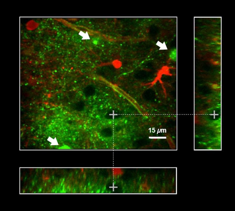 A better sensor: imaging potassium dynamics A better sensor: imaging potassium dynamics