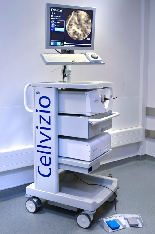 Cellvizio: optical biopsies