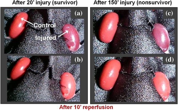 Organ damage: spectroscopy reveals hidden details