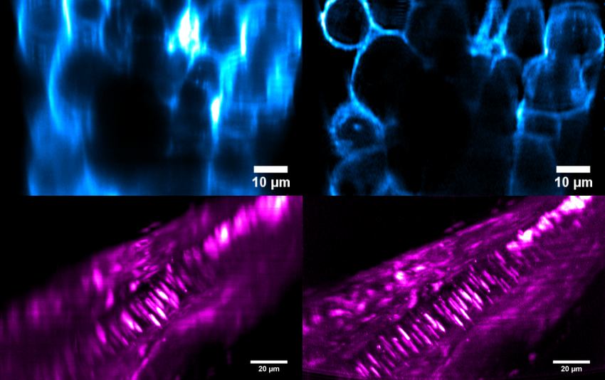 Benefits of an Airy profile: seeing more clearly