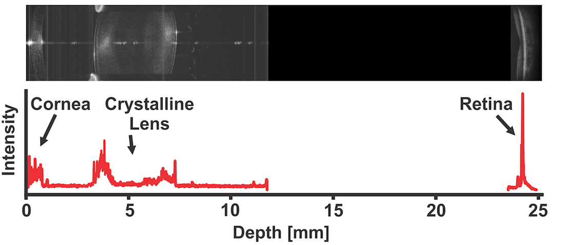 OCT image of the eye's anterior segment