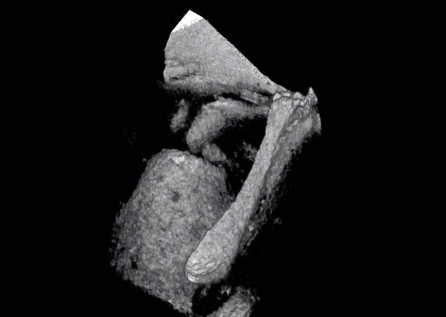 Hearing aid: visualizing the middle ear