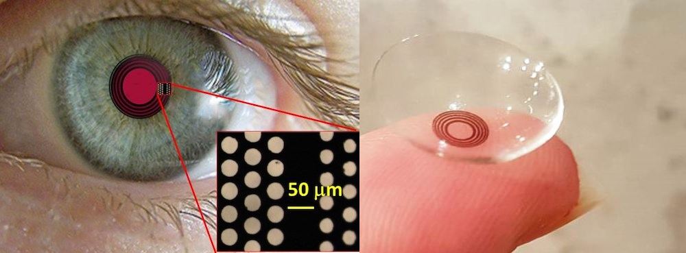 Hole story: treating presbyopia