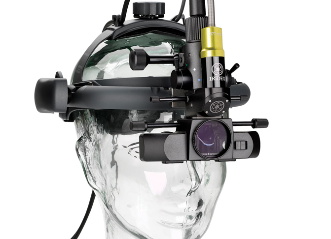 Recall hit Iridiex's financial performance in Q4, 2017: TruFocus LIO.