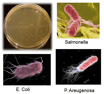 Small but deadly: examples of the bacteria Waterspy will detect. 