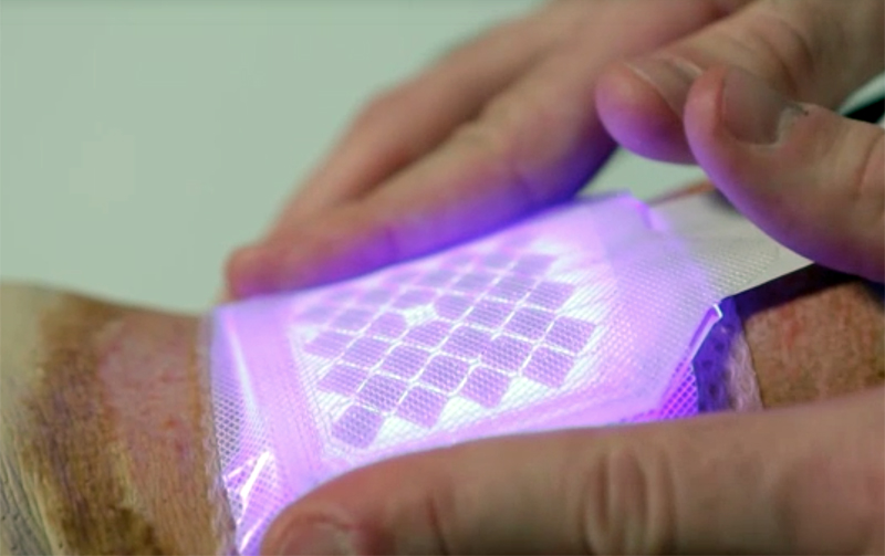 Patched up: Blue light is known for its anti-microbial, anti-inflammatory effects.