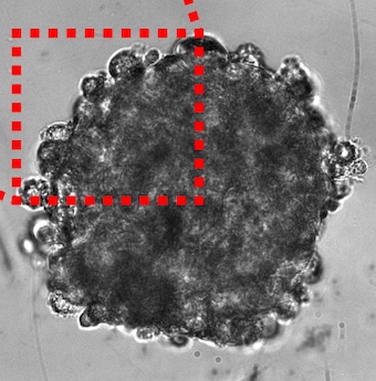 Physical properties: one clue to anti-cancer efficacy