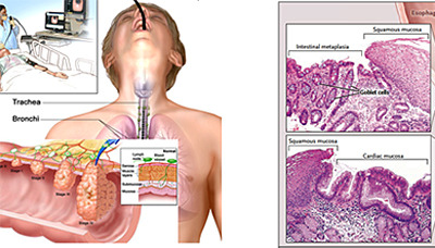 Imaging with light instead of radioactivity leads to 100x greater sharpness.