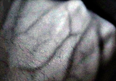 You're so vein: illumination with a SERIS NIR perovskite LED on the back of a fist.