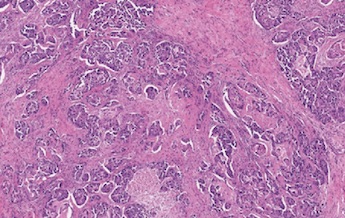 Regions of interest: histopathology and DRS spectra 