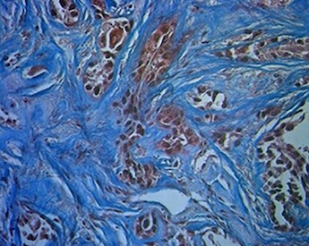 Act of resistance: Raman sees the signs