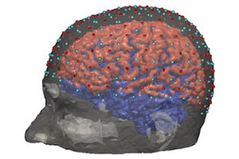 Brain power: improved imaging
