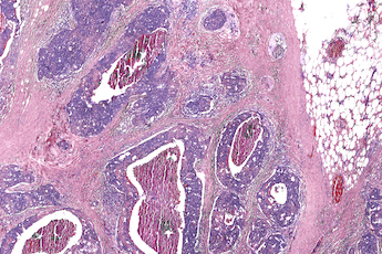 Hybrid approach: potentially cheaper procedure, faster results.