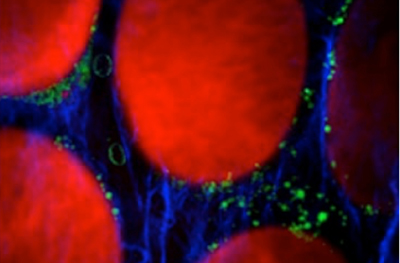 Cancer challenge: CARMEN aims to integrate three imaging methods.