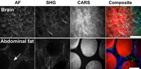 Overlay of different biomedical imaging methods. 