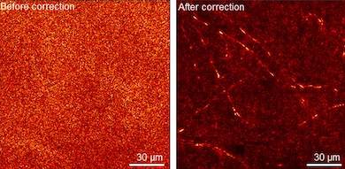 LS-RMM: Imaging within the skull