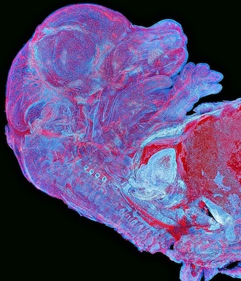 Asia-Pacific regional prize winner