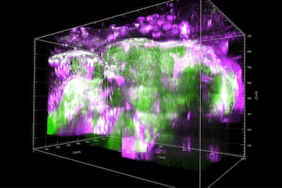 Adult zebrafish brain: valuable insight