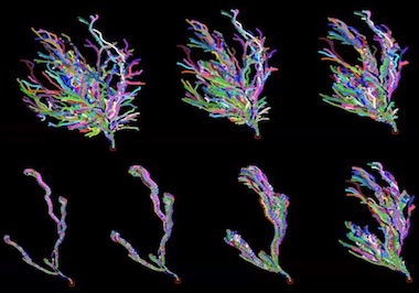 Brain activity: neural networks