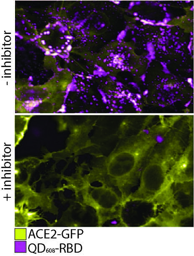 Viral impact: SARS-CoV-2 virus binds to human cells.