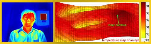 Thermal image of FDA scientist Q. Wang, with temperature map of an eye.