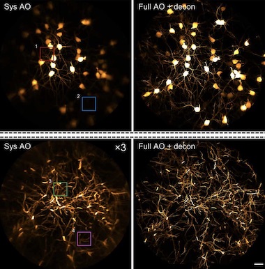 Seeing more deeply: mouse hippocampus