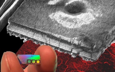 OCT: continued breakthroughs