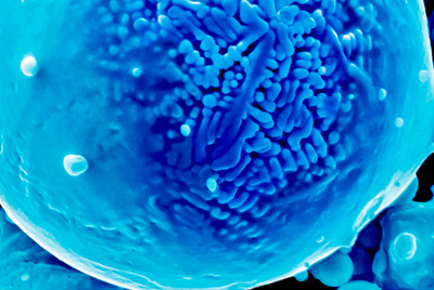 Colorized electron micrograph of a nickel powder alloy from the study.