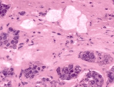 Virtual staining: rapid analysis