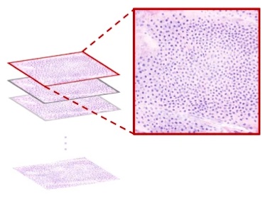 Image analysis: faster diagnosis