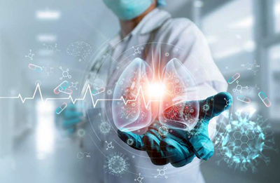 Icovid supports radiologists in the assessment of CT images of Covid-19 patients.