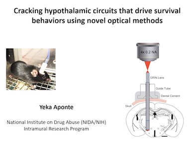 Pain and gain: the brain's response