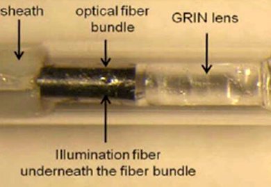 Plaque analysis: spotting potential danger