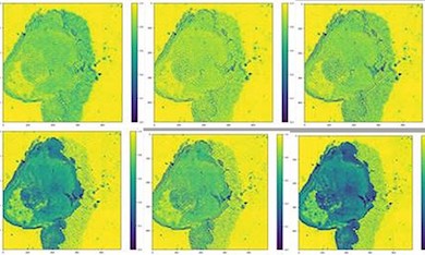 Infrared imaging to spot cancer cells