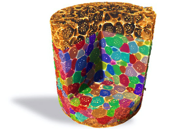 Aluminum copper alloy imaged and analyzed with the Xradia CrystalCT. 