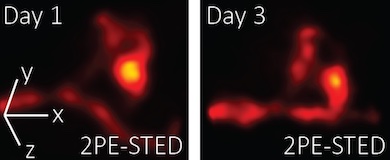 Spot the difference: 3D STED