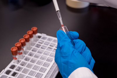 Ethos Labs has launched a molecular test that can detect key virus strains.