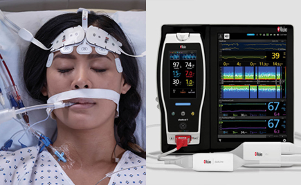 Masimo Root with O3 Regional Oximetry and SedLine Brain Function Monitor.