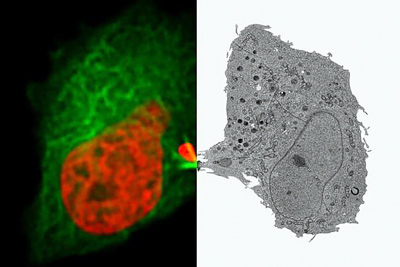 Images from Leica Microsystems' Live-Cell CLEM workflow. Click for info.