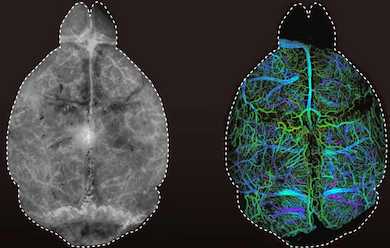 Clearly seen: blood vessels 