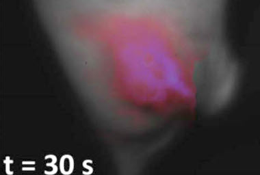 Helpful delay: tumor location