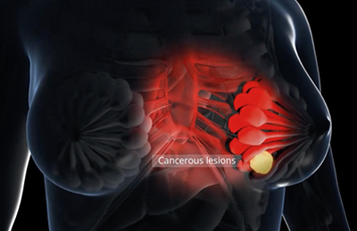 OAI provides new insights into a variety of diseases.