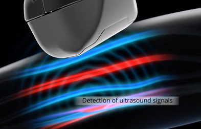 Optoacoustic imaging offers a multitude of applications.