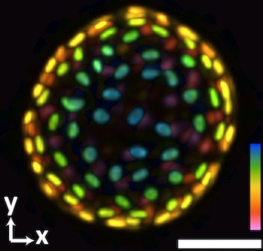 Organoid organization: custom-built microscope