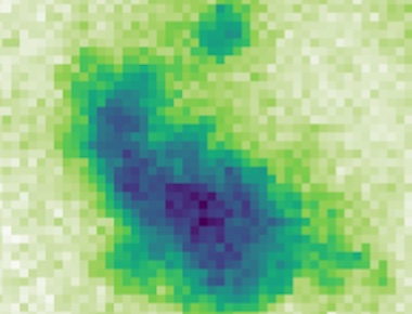 Imaging disease progress: speckle put to use