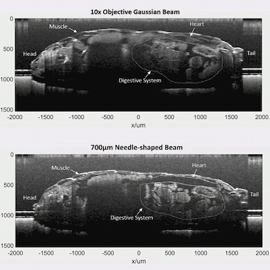 Needle point: beating heart