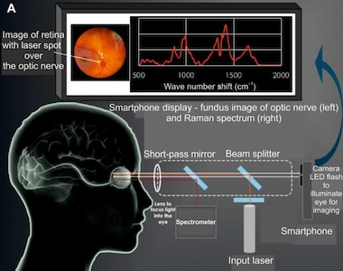 Window on the brain: biomarkers identified