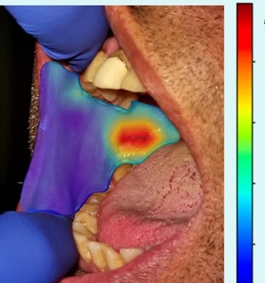 Oral health: effective testing