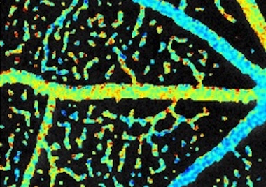 Early signs of disease: capillary oxygen