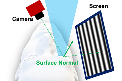 Camera records light patterns as they reflect off the eye’s surface.